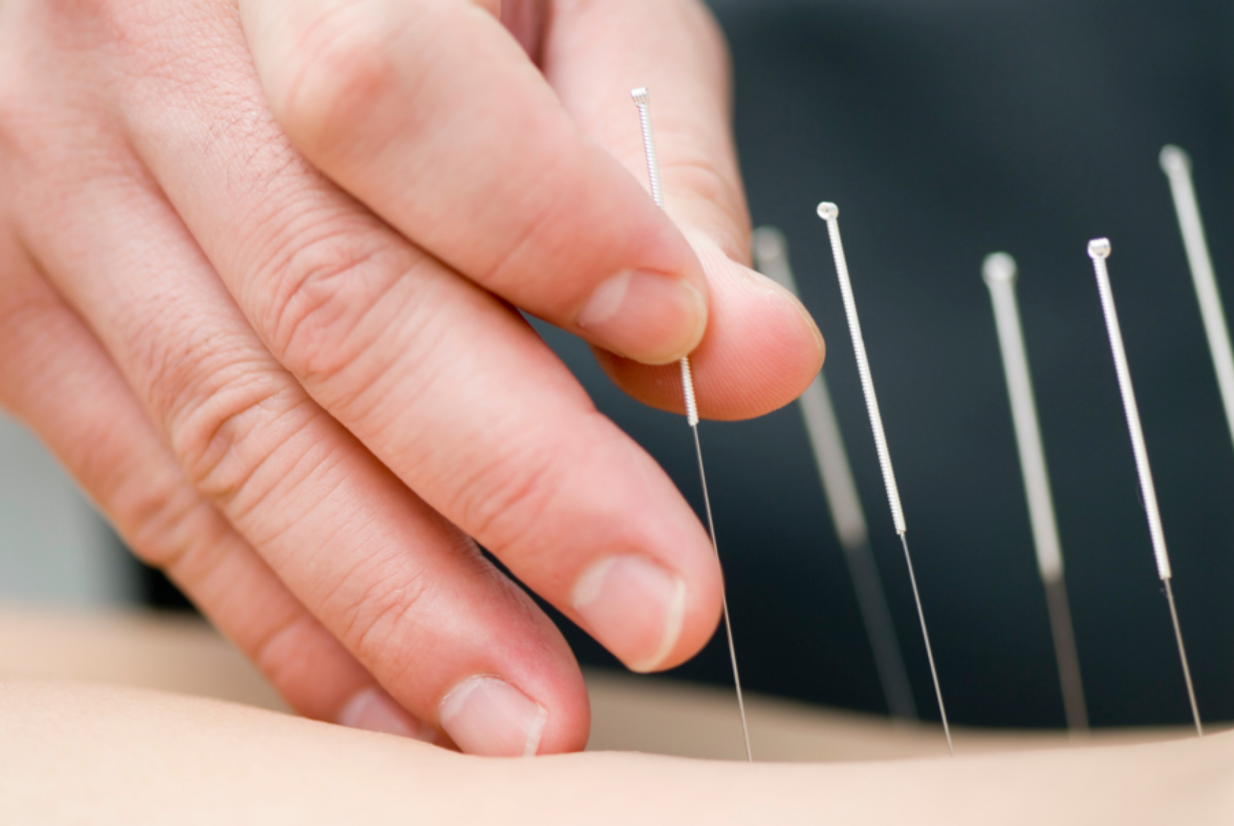 more research is needed to find out if acupuncture